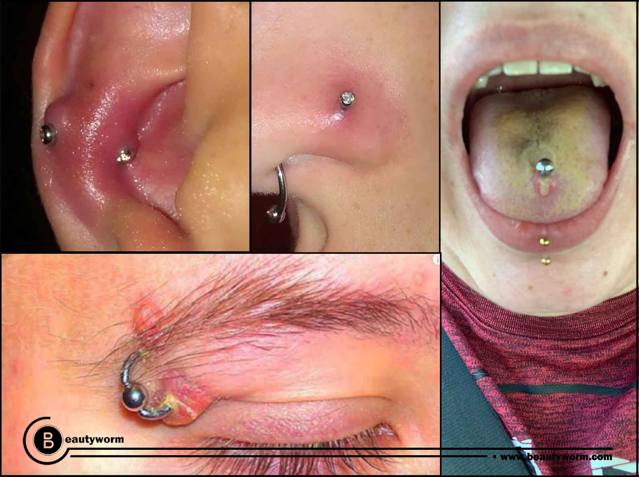 Piercing risks and infection
