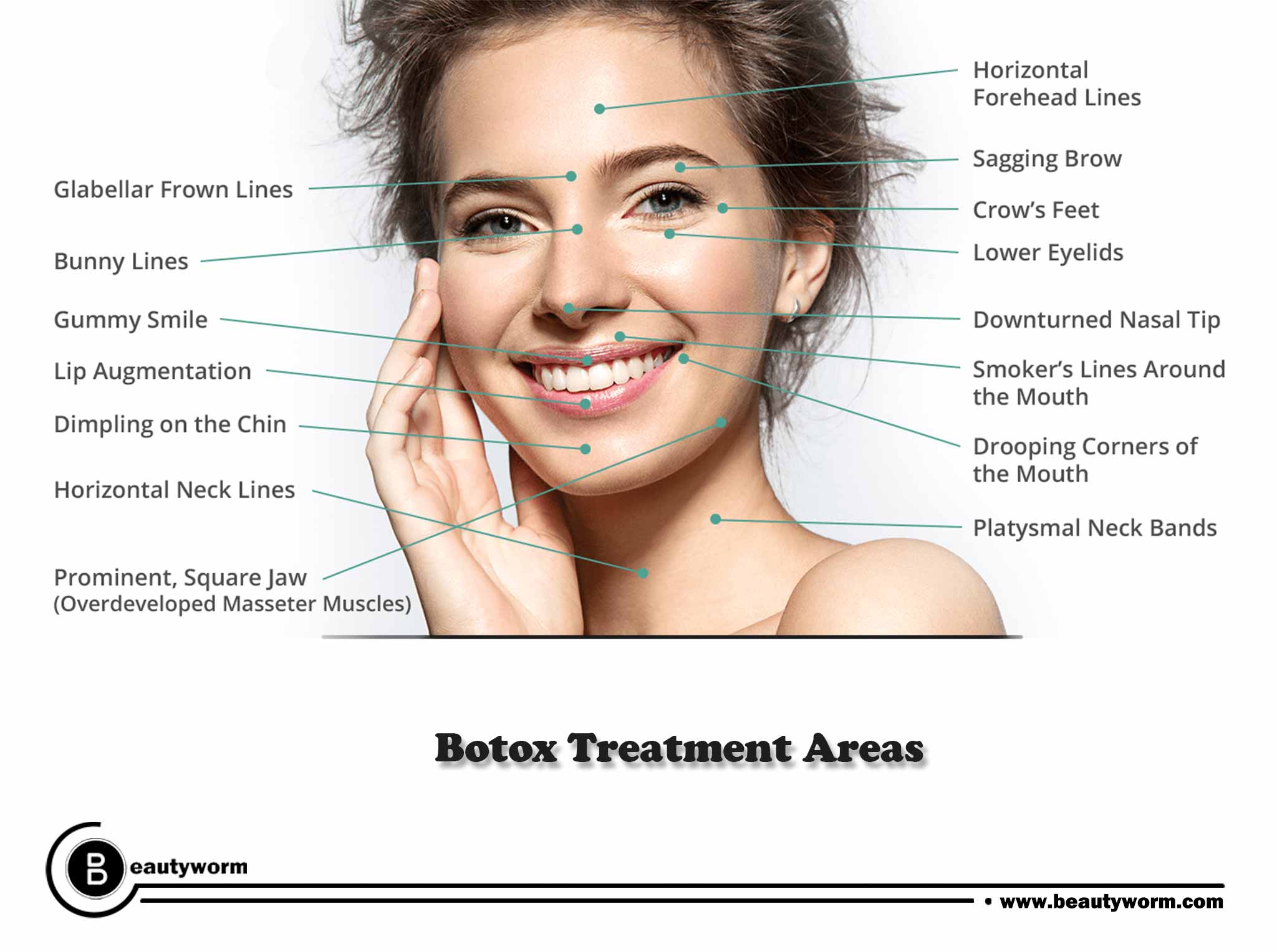 What is Botox used for?