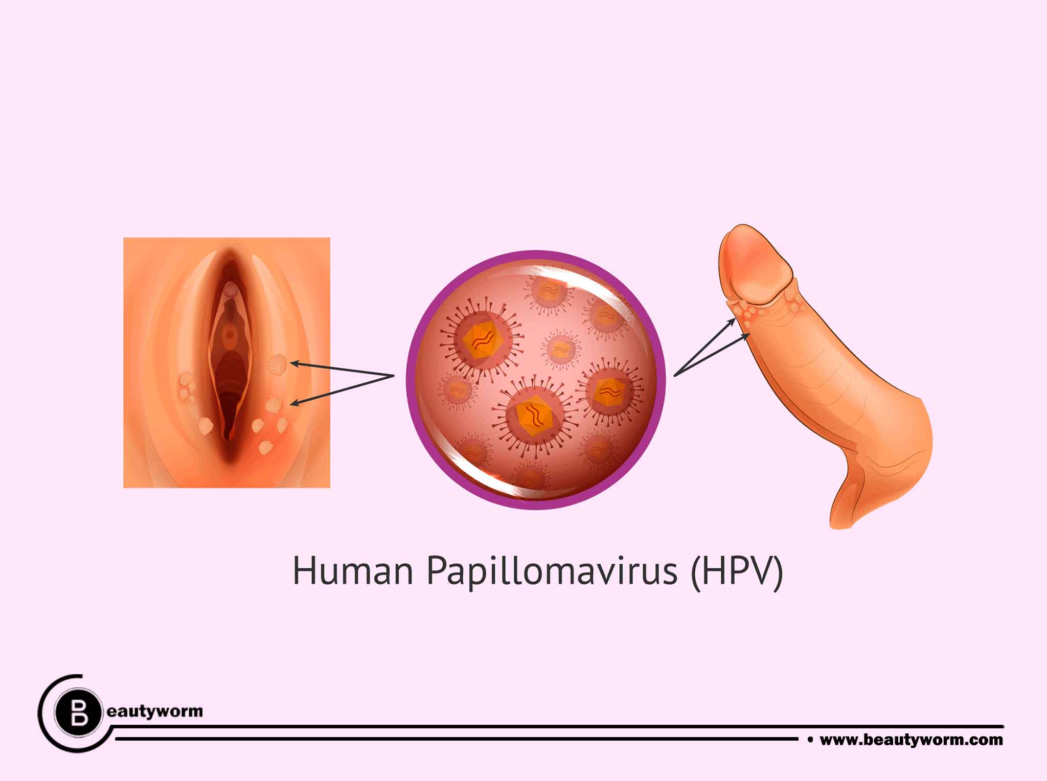 How is HPV spread?