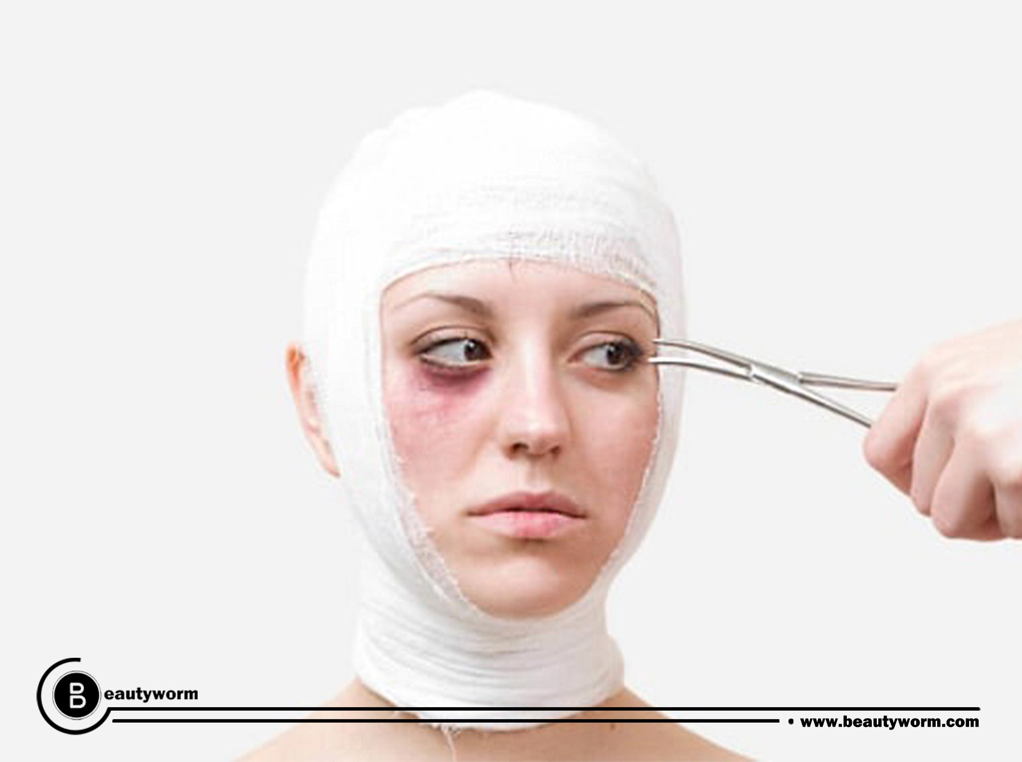 Risks and side effects cosmetic surgery